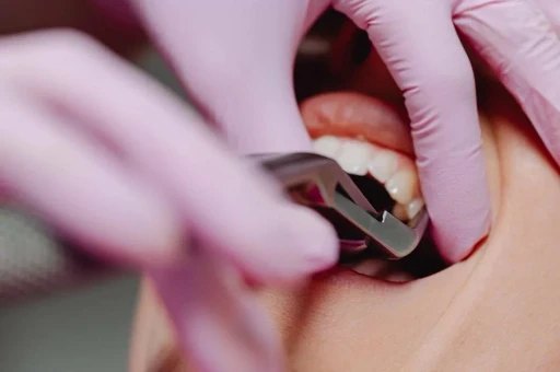 Dentysta w różowych rękawiczkach podczas zabiegu w jamie ustnej